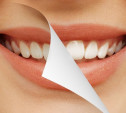 Бьюти-тренд: косметическое осветление зубов