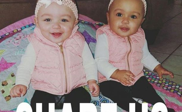 Фотография близнецов с разным цветом кожи удивила интернет