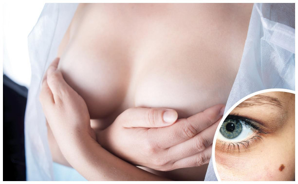 Рак груди и кожи: как проверить себя?