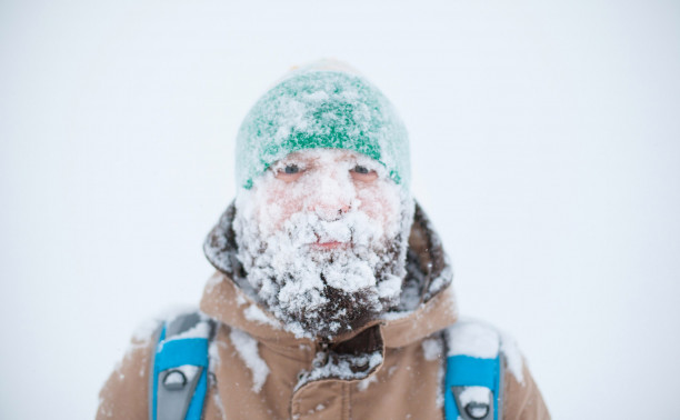 Мороз против красоты: как холод старит кожу, портит волосы и вызывает головную боль
