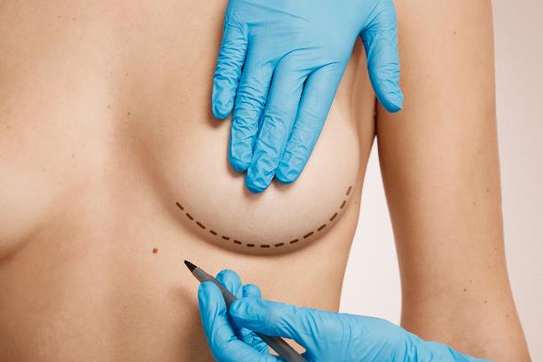 woman-marked-out-for-cosmetic-surgery.jpg