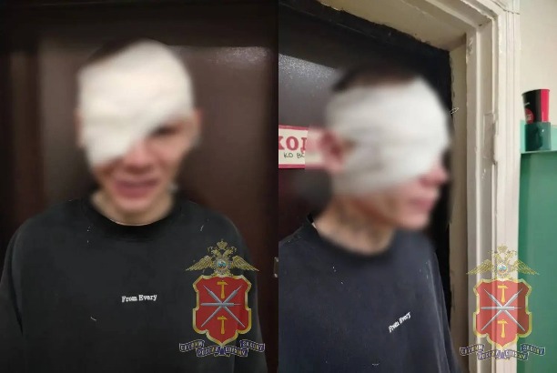Пьяная драка в кафе «Три пескаря» в Кимовске: мужчина ударил посетителя бокалом по голове