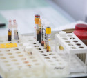 В Тульской области число подтвержденных случаев коронавируса достигло 436