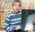 Алексинца осудят за ранение подростка из пневматики