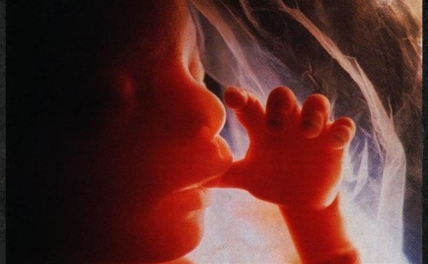 Минздрав не поддерживает идею отказа от бесплатных абортов