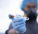 Россия поднялась на вторую строчку по количеству заболевших коронавирусом