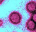 Иммунолог: вирус гриппа может принять пандемическую форму