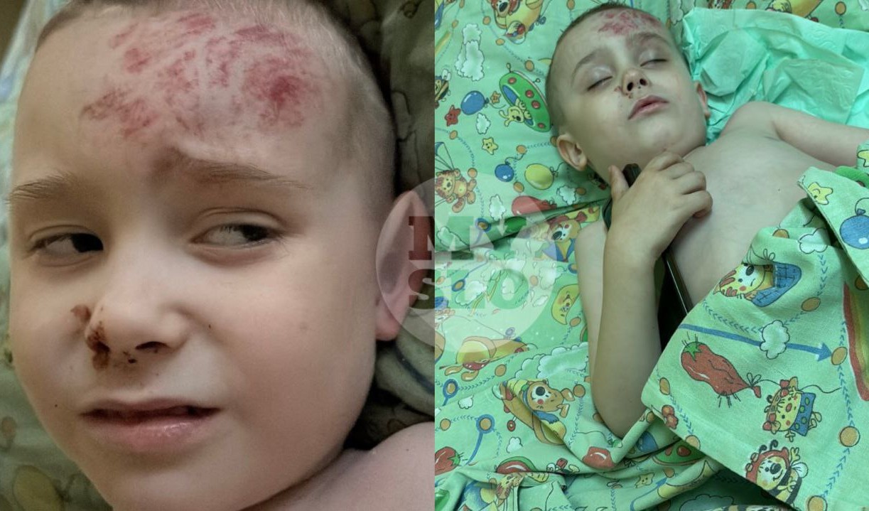 В «Золотом городе» на ребенка рухнула скульптура: дело скоро направят в суд