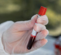 За неделю в Тульской области коронавирусом заболели 200 человек