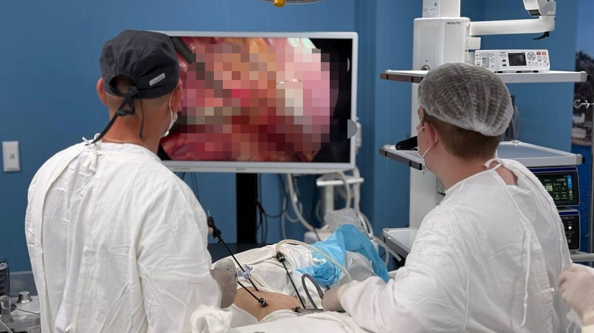 Тульские онкологи впервые удалили тимус, избежав рассечения грудины 