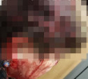 Лопатой разбила голову врачу: невменяемую женщину отправили в психбольницу