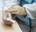 В Тульской области за сутки подтвердилось 326 случаев ковида, 53 человека госпитализировано