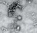 Советы Роспотребнадзора: как не заразиться опасным коронавирусом