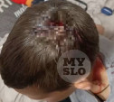 На стадионе в Липках на голову 10-летнего ребенка упали футбольные ворота