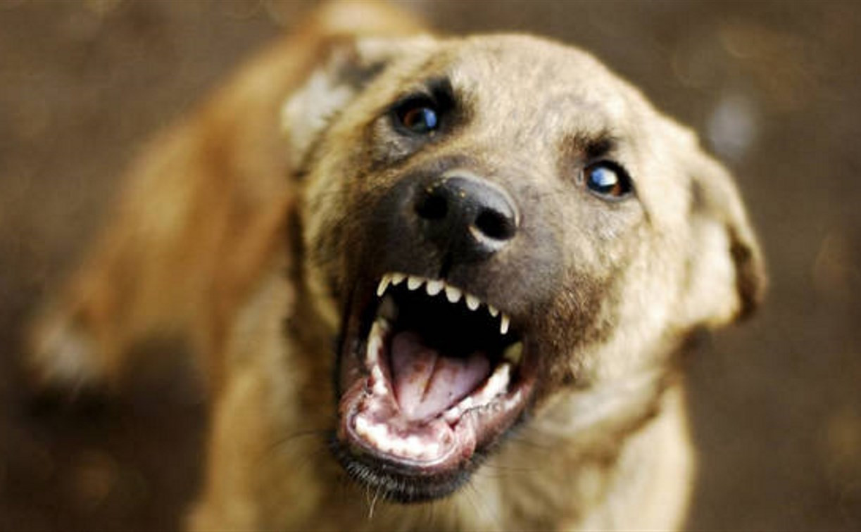 В Веневском районе бродячая собака напала на несовершеннолетнего