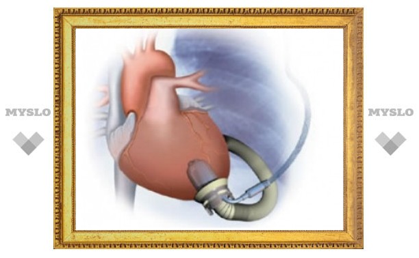 Итальянскому подростку заменили левый желудочек электронасосом
