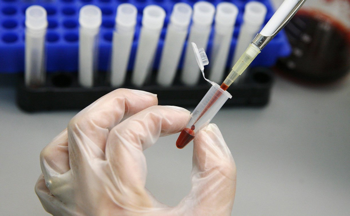 Туляки могут пройти анонимный тест на ВИЧ