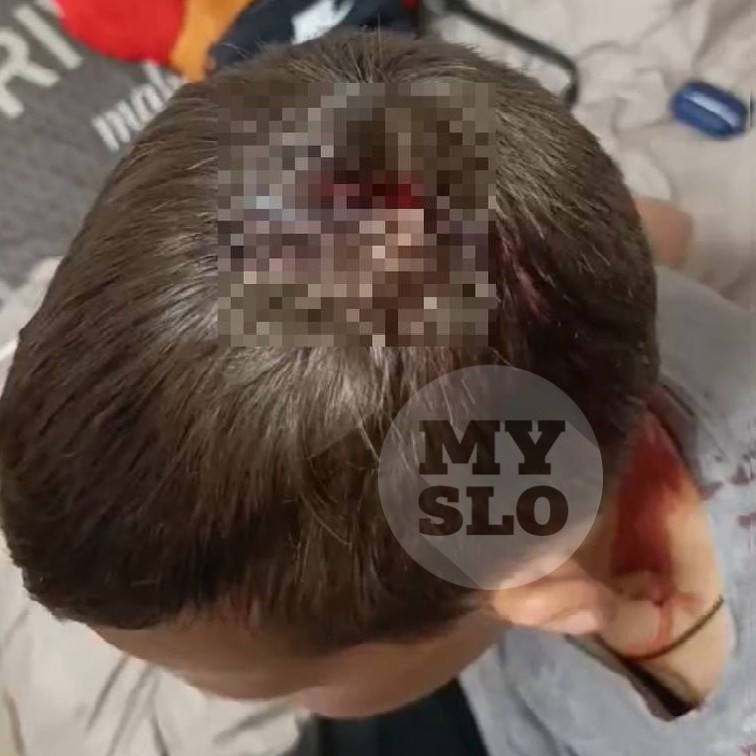Бастрыкин взял на контроль дело с падением футбольным ворот на голову ребенка в Липках 