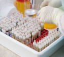 В Тульской области за неделю ОРВИ и гриппом заболели 6808 человек
