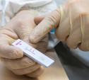 Статистика за сутки: в Тульской области 56 новых случаев коронавируса и 6 смертей