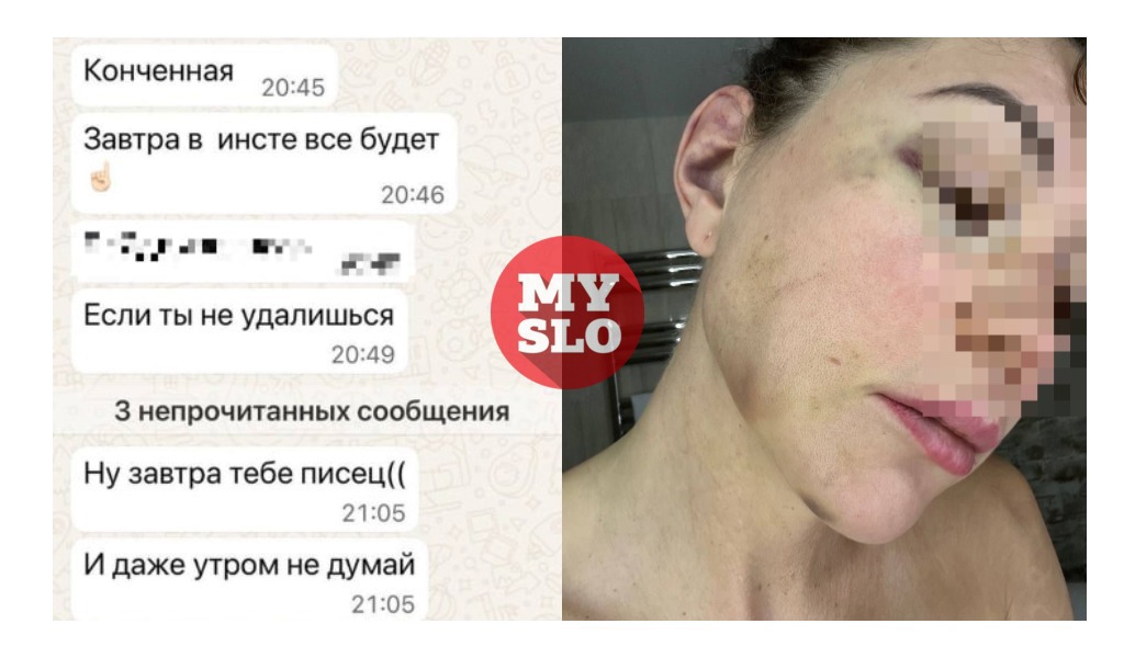 Избил, разнес машину топором, угрожал слить хоум-видео: туляк полгода преследует бывшую жену 