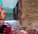 В Энгельсе жестоко избили парня из Тулы (фото 18+)
