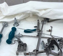 Впервые в Туле провели операцию по эндопротезированию коленного сустава, используя инновации