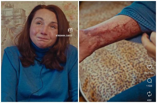 Тульская ведущая Елена Тикова впервые рассказала, как потеряла дочь в страшном пожаре 