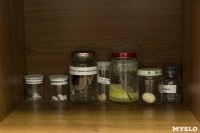 Тульские патологоанатомы показали коллекцию «экспонатов» своей коллекции , Фото: 1