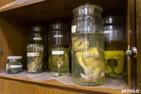 Тульские патологоанатомы показали коллекцию «экспонатов» своей коллекции , Фото: 13