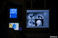 Тульские медики впервые удалили глубинную опухоль головного мозга, Фото: 3