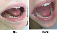 В какой тульской стоматологии лечить зубы, Фото: 4