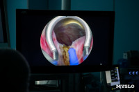  Лазерный резектоскоп: в Тульском онкодиспансере внедрен новый метод борьбы с опухолями, Фото: 15