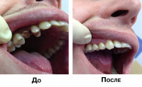 В какой тульской стоматологии лечить зубы, Фото: 5