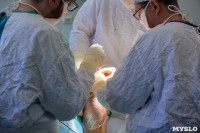 Уникальная операция на колене, Фото: 1